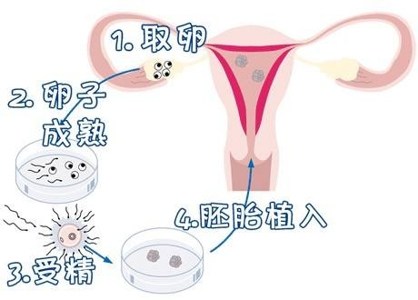 关于青碧生殖